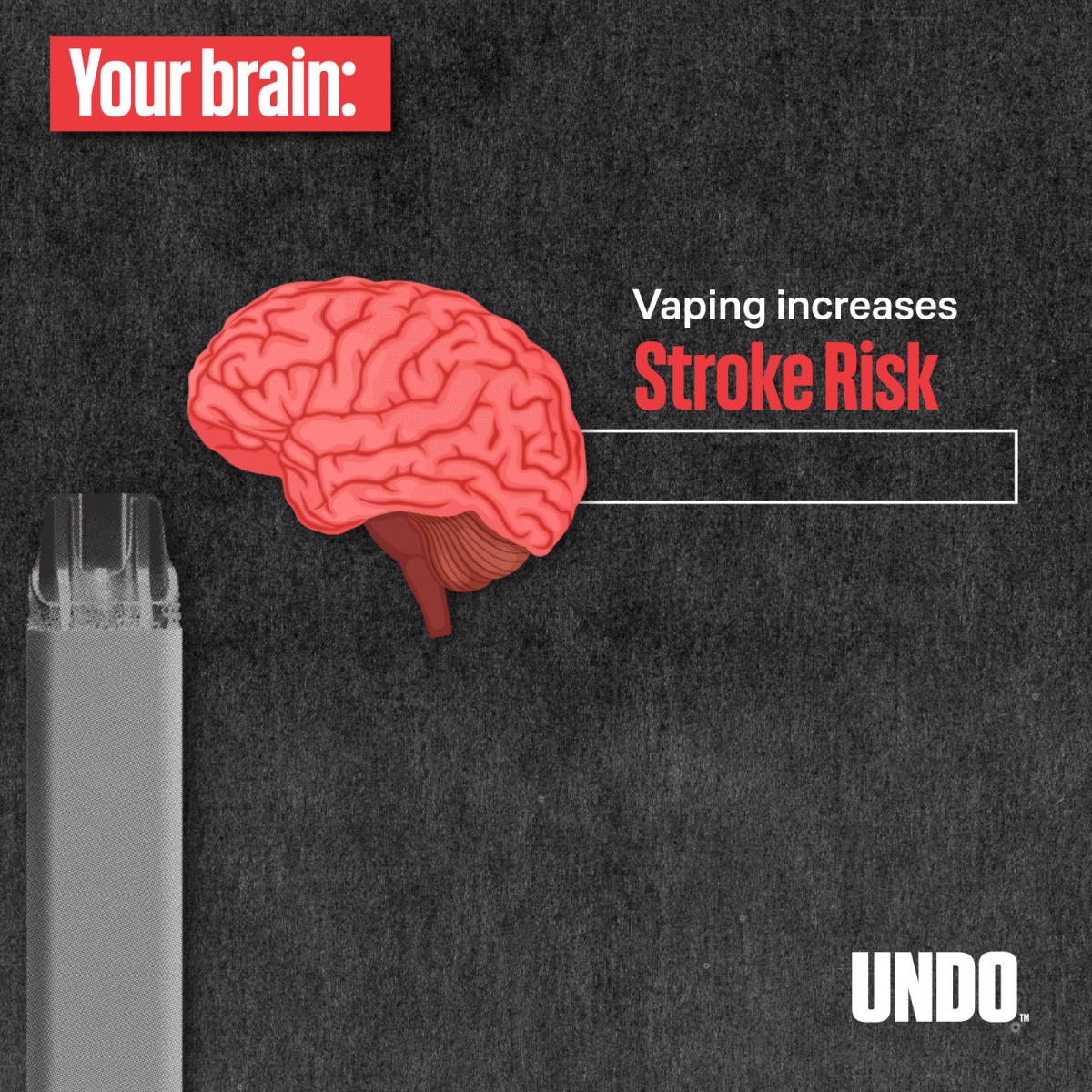Your Brain: Vaping Increases Stroke Risk